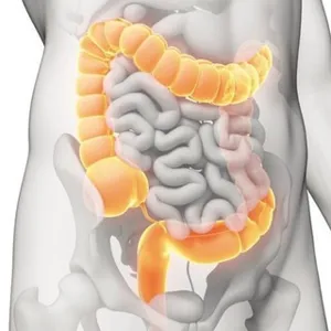 Khoa học về Bệnh Viêm Ruột: UC, Crohn’s, IBS. Bạn Có Thể Ăn Mọi Thứ!!