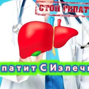 Viêm Gan C